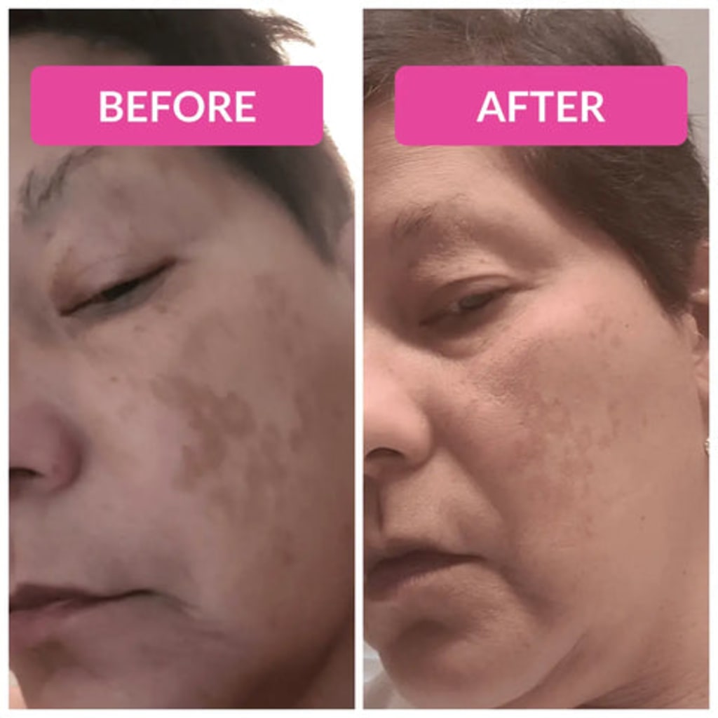 Nuvéra - All in One Serum